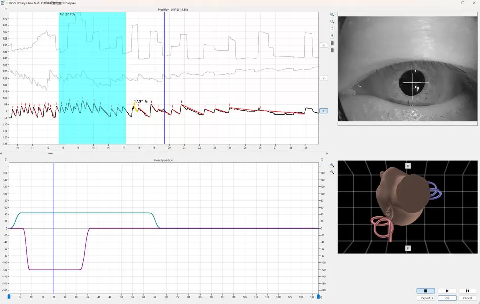 Suivi oculaire 3D int&eacute;gr&eacute; avec VertiGoggles&trade;