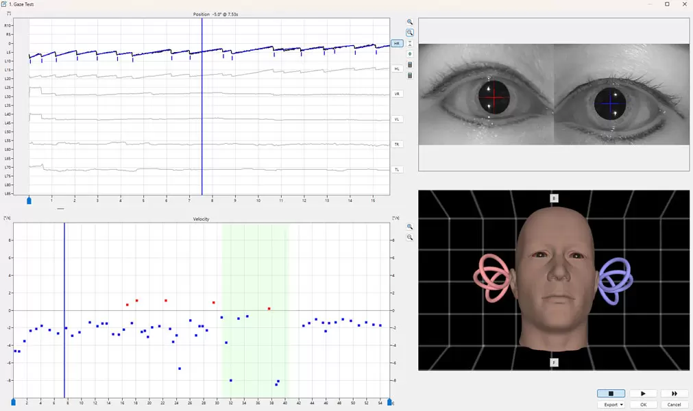 R&eacute;vision intelligente et flux de travail interconnect&eacute;